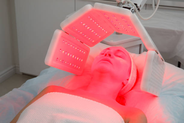 Rosacea LED Light Therapy
