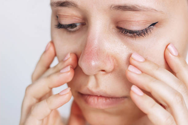 best led mask for sensitive skin australia