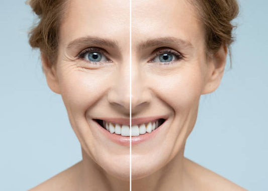 what is the best led face mask for wrinkles